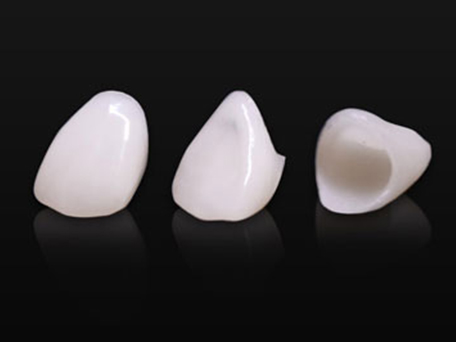 北13ハニー歯科の「技工物の紹介」画像