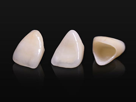 北13ハニー歯科の「技工物の紹介」画像