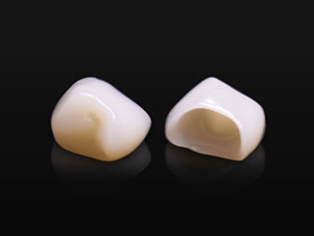 北13ハニー歯科の「技工物の紹介」画像