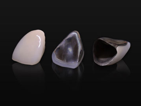 北13ハニー歯科の「技工物の紹介」画像