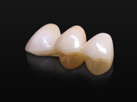 北13ハニー歯科の「技工物の紹介」画像