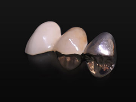 北13ハニー歯科の「技工物の紹介」画像