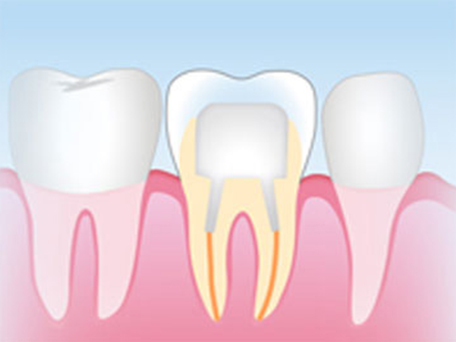北13ハニー歯科の「技工物の紹介」画像