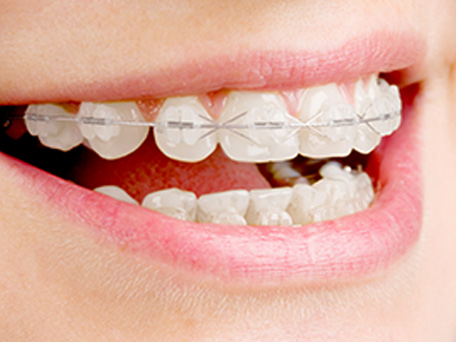 北13ハニー歯科の「診療案内」画像