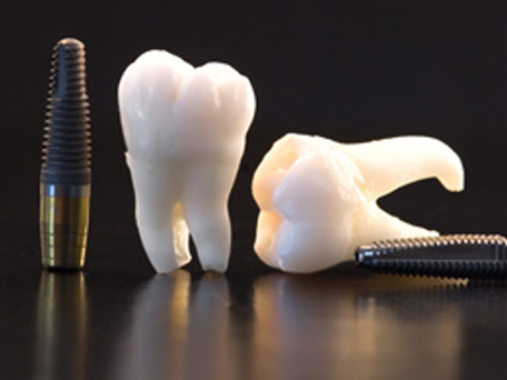 北13ハニー歯科の「診療案内」画像